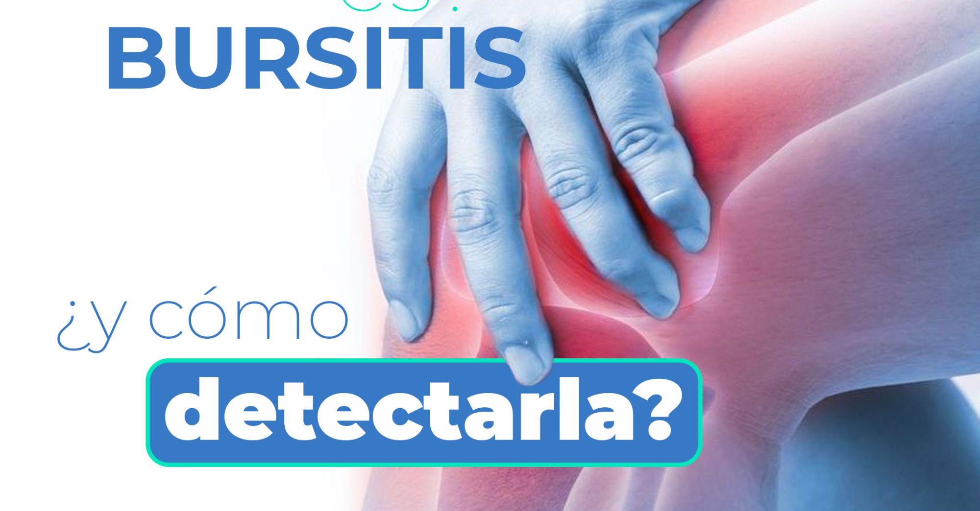 Bursitis